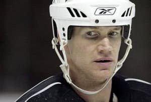 pronger face